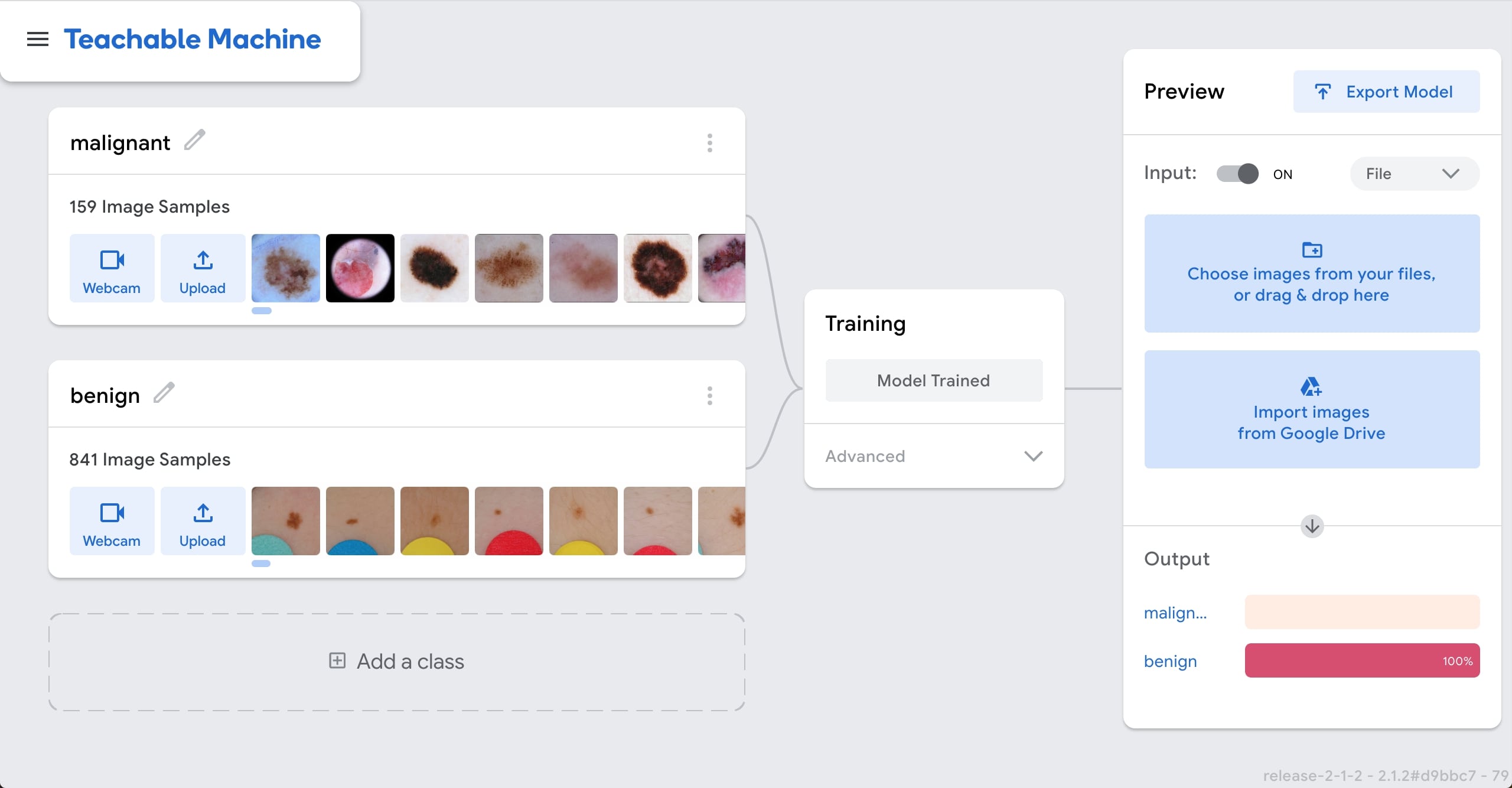 Skin Cancer Classifier Image